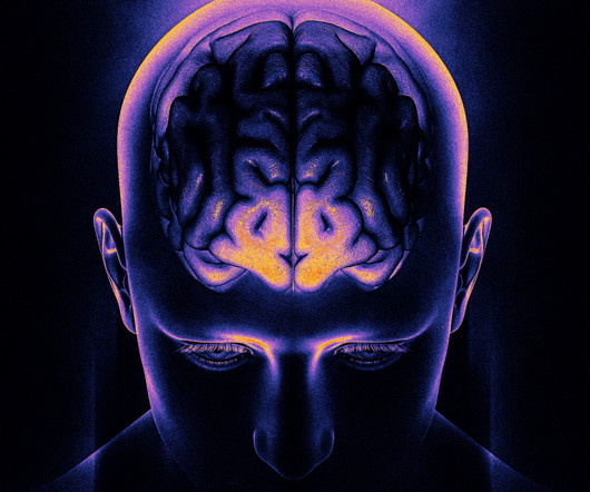 article thumbnail